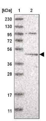 Western Blot: DEPTOR/DEPDC6 Antibody [NBP1-85255]