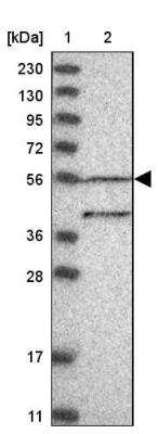 Western Blot: DEPTOR/DEPDC6 Antibody [NBP1-85256]