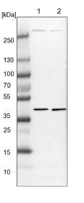 Western Blot: DEPTOR/DEPDC6 Antibody [NBP1-85256]