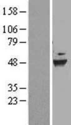 Western Blot: DEPTOR/DEPDC6 Overexpression Lysate [NBL1-09835]