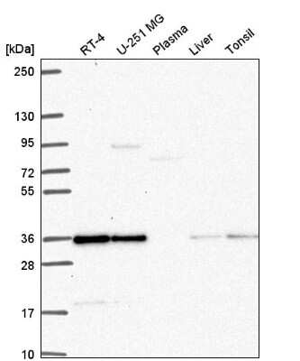 Western Blot: DERA Antibody [NBP2-58642]