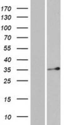 Western Blot: DERA Overexpression Lysate [NBP2-07110]