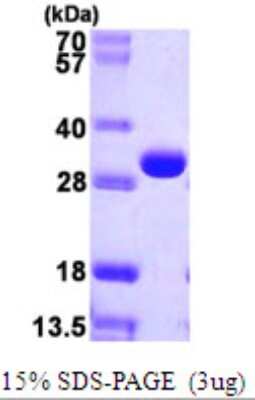 SDS-PAGE: Recombinant E. coli DERA His Protein [NBP2-22649]