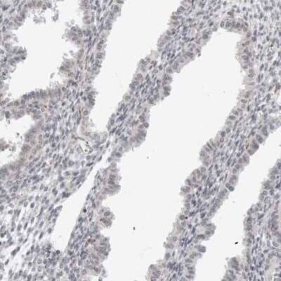 Immunohistochemistry-Paraffin: DERP13 Antibody [NBP1-84271]