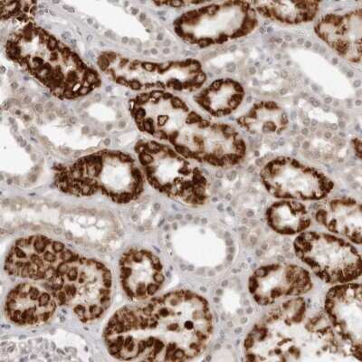 Immunohistochemistry-Paraffin: DERP13 Antibody [NBP1-84271]