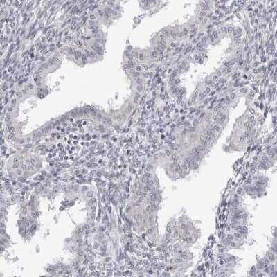 Immunohistochemistry-Paraffin: DERP13 Antibody [NBP1-84272]