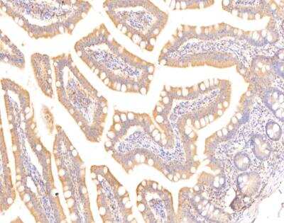 Immunohistochemistry-Paraffin: DERP13 Antibody [NBP3-12786]