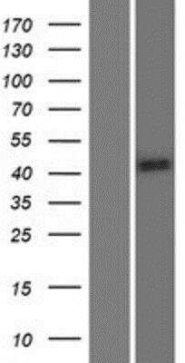 Western Blot: DERP13 Overexpression Lysate [NBP2-06296]