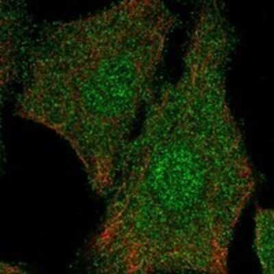 Immunocytochemistry/ Immunofluorescence: DERP6 Antibody [NBP3-17239]