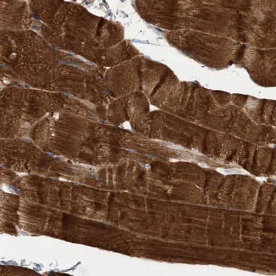 Immunohistochemistry-Paraffin: DERP6 Antibody [NBP1-85250]