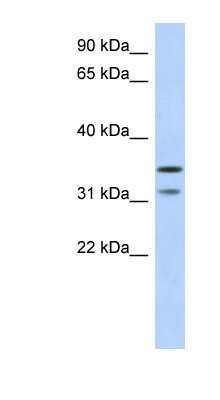 Western Blot: DERP6 Antibody [NBP1-57696]