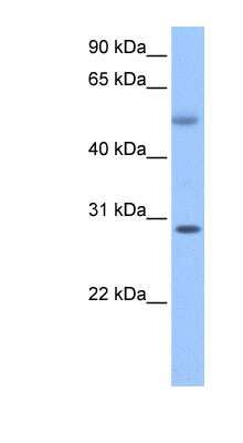 Western Blot: DERP6 Antibody [NBP1-57705]