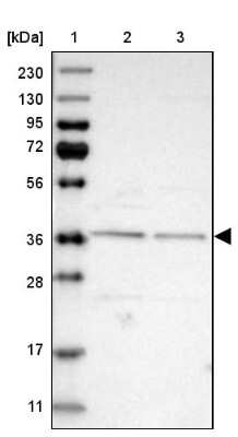 Western Blot: DERP6 Antibody [NBP1-85250]