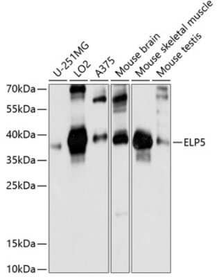 Western Blot: DERP6 AntibodyAzide and BSA Free [NBP2-92191]