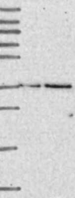 Western Blot: DERP6 Antibody [NBP3-17239]