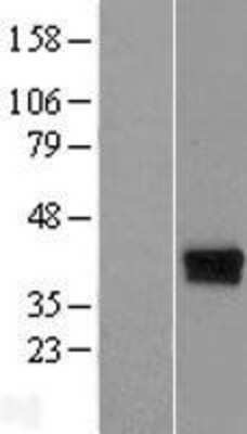 Western Blot: DERP6 Overexpression Lysate [NBP2-04567]