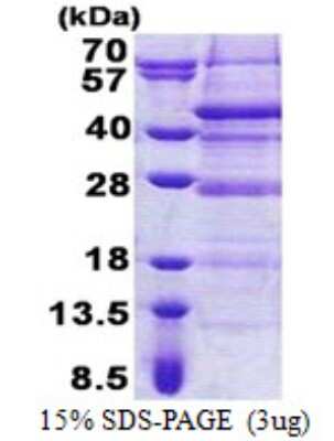 SDS-PAGE: Recombinant Human DERP6 His Protein [NBP2-23019]