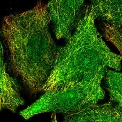 Immunocytochemistry/ Immunofluorescence: DET1 Antibody [NBP2-13914]