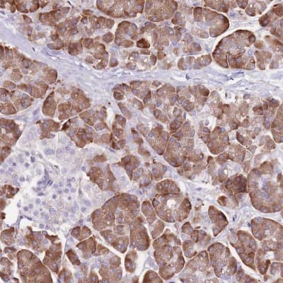 Immunohistochemistry-Paraffin: DET1 Antibody [NBP2-13914]