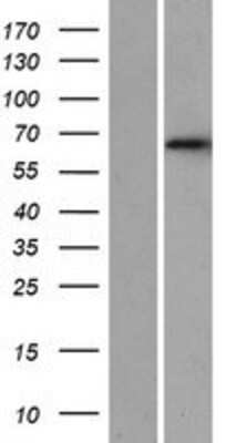 Western Blot: DET1 Overexpression Lysate [NBP2-06888]