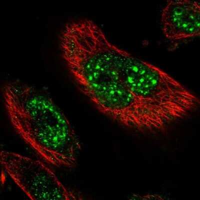 Immunocytochemistry/ Immunofluorescence: DEXI Antibody [NBP1-81015]