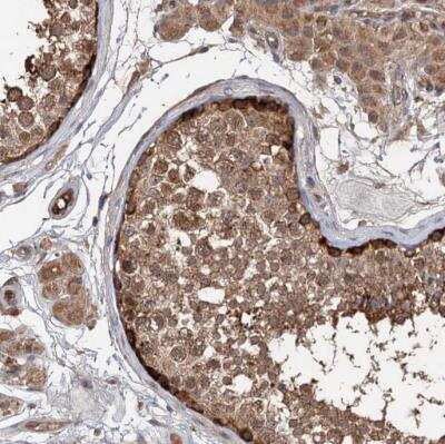 Immunohistochemistry-Paraffin: DEXI Antibody [NBP1-81015]