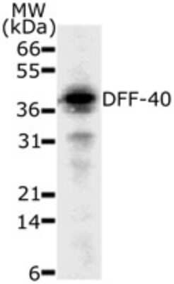 Western Blot: DFF40/CAD Antibody (36A349)BSA Free [NB120-13592]