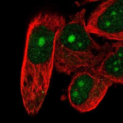 Immunocytochemistry/ Immunofluorescence: DFF40/CAD Antibody [NBP2-55648]