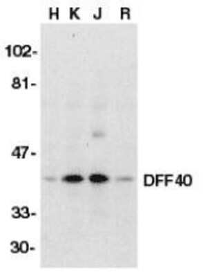 Western Blot: DFF40/CAD AntibodyBSA Free [NBP1-76948]