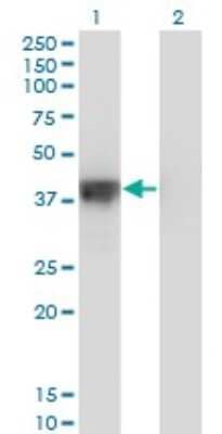 Western Blot: DFF45/ICAD Antibody (3A11) [H00001676-M05]