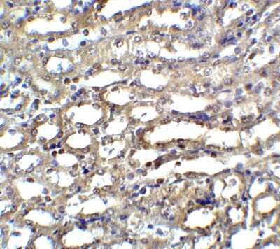 Immunohistochemistry: DFF45/ICAD Antibody - BSA Free [NBP1-76471]