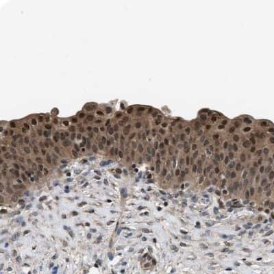 Immunohistochemistry-Paraffin: DFF45/ICAD Antibody [NBP1-85247]