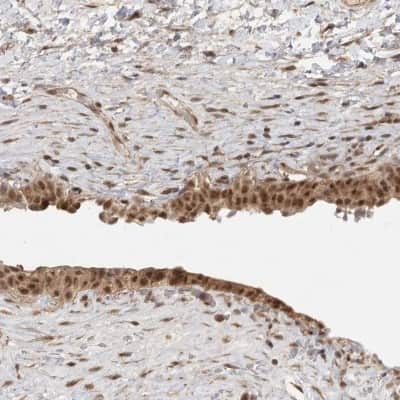 Immunohistochemistry-Paraffin: DFF45/ICAD Antibody [NBP1-85248]