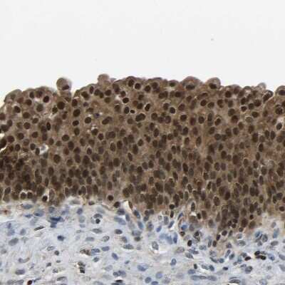 Immunohistochemistry-Paraffin: DFF45/ICAD Antibody [NBP1-85249]