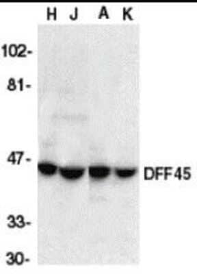 Western Blot: DFF45/ICAD AntibodyBSA Free [NBP1-77034]