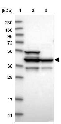 Western Blot: DFF45/ICAD Antibody [NBP1-85247]