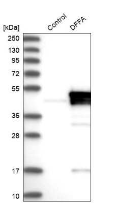 Western Blot: DFF45/ICAD Antibody [NBP1-85248]