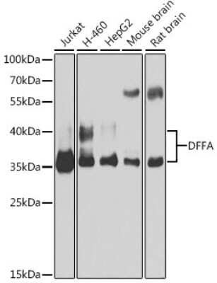 Western Blot: DFF45/ICAD AntibodyBSA Free [NBP3-03452]