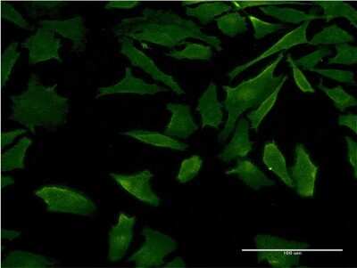 Immunocytochemistry/ Immunofluorescence: DFNB31 Antibody (2D12) [H00025861-M05]