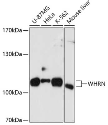 Western Blot: DFNB31 AntibodyAzide and BSA Free [NBP2-92038]