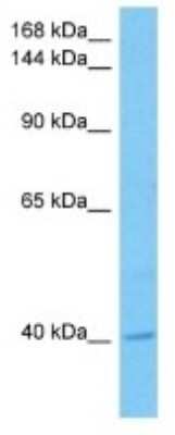 Western Blot: DFNB31 Antibody [NBP3-10840]