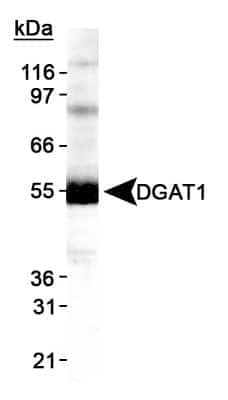 Western Blot: DGAT1 AntibodyBSA Free [NB110-41487]