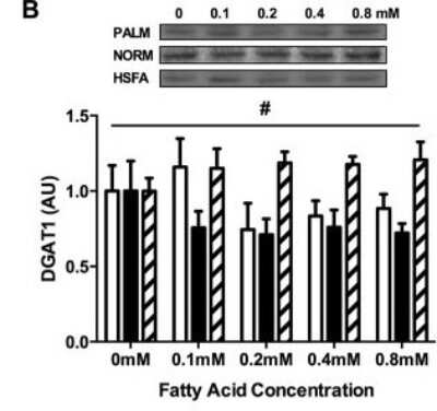 Western Blot: DGAT1 AntibodyBSA Free [NB110-41487]