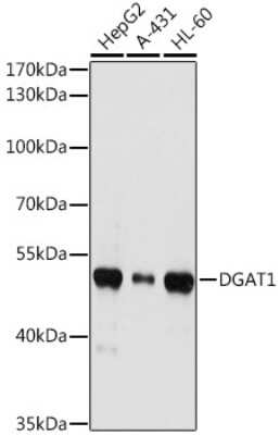 Western Blot: DGAT1 AntibodyBSA Free [NBP2-92984]