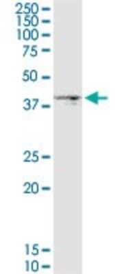 Western Blot: DGAT2 Antibody (4C1) [H00084649-M03]