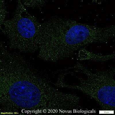 Immunocytochemistry/ Immunofluorescence: DGAT2 Antibody - BSA Free [NBP3-05769]