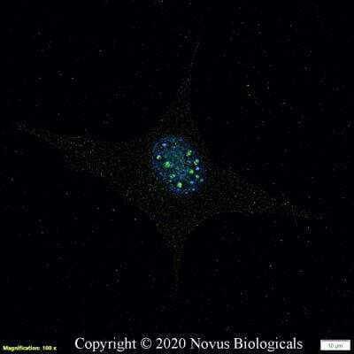 Immunocytochemistry/ Immunofluorescence: DGAT2 Antibody - BSA Free [NBP3-05769]