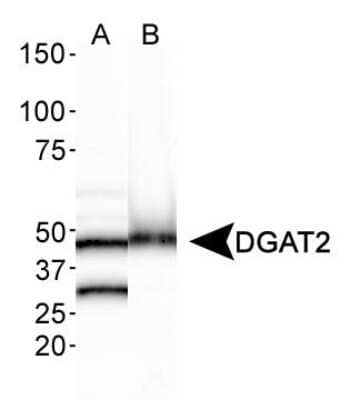 Western Blot: DGAT2 AntibodyBSA Free [NBP1-71701]