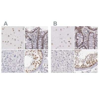 Immunohistochemistry-Paraffin: DGCR14 Antibody [NBP1-84258]