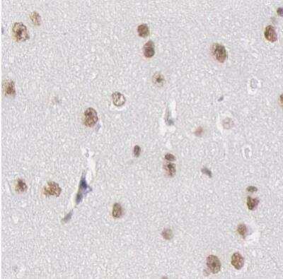 Immunohistochemistry-Paraffin: DGCR14 Antibody [NBP1-84258]